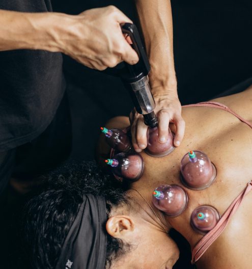 A person receives cupping therapy on their back to promote muscle recovery and relaxation.
